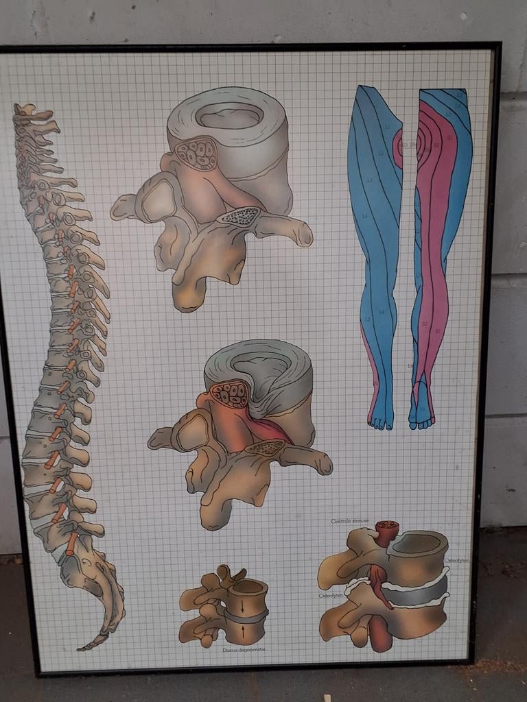 Image anatomique médicale 60x80cm, Enlèvement
