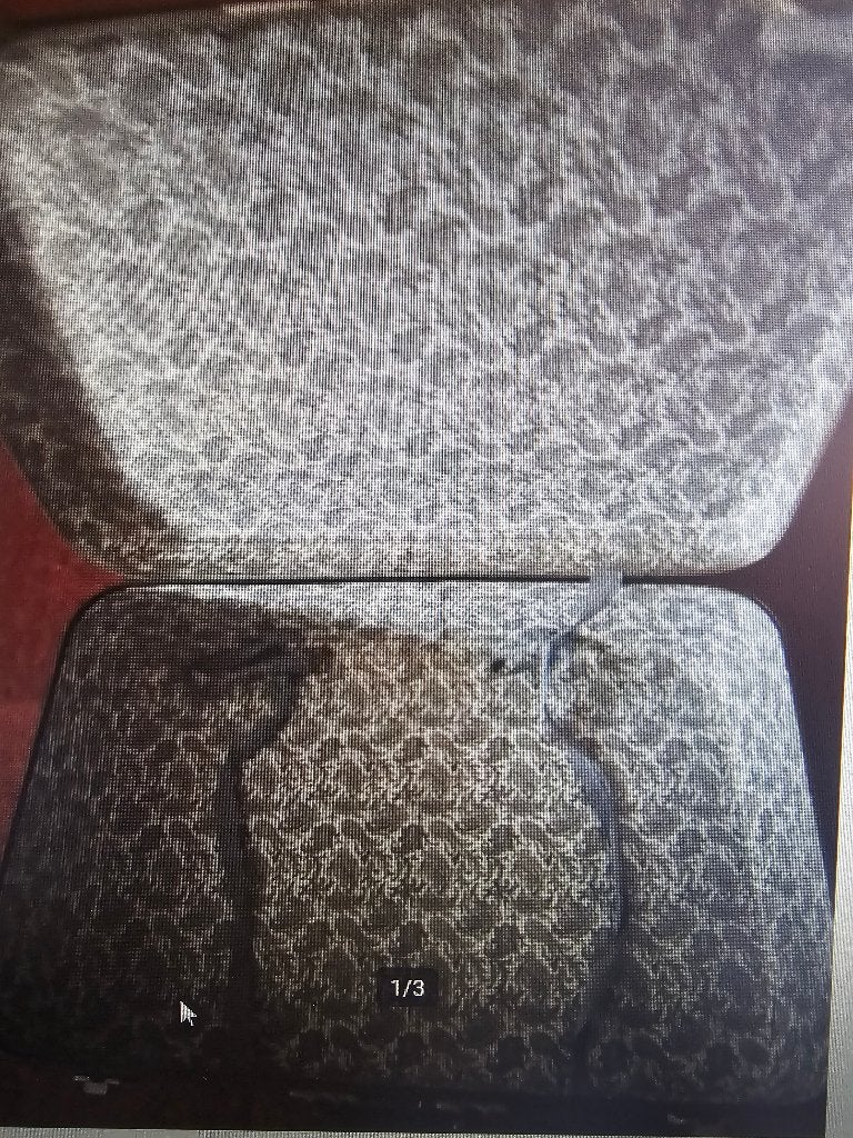 Valise "vintage", 35 à 45 cm, Plastique dur, Enlèvement, Utilisé