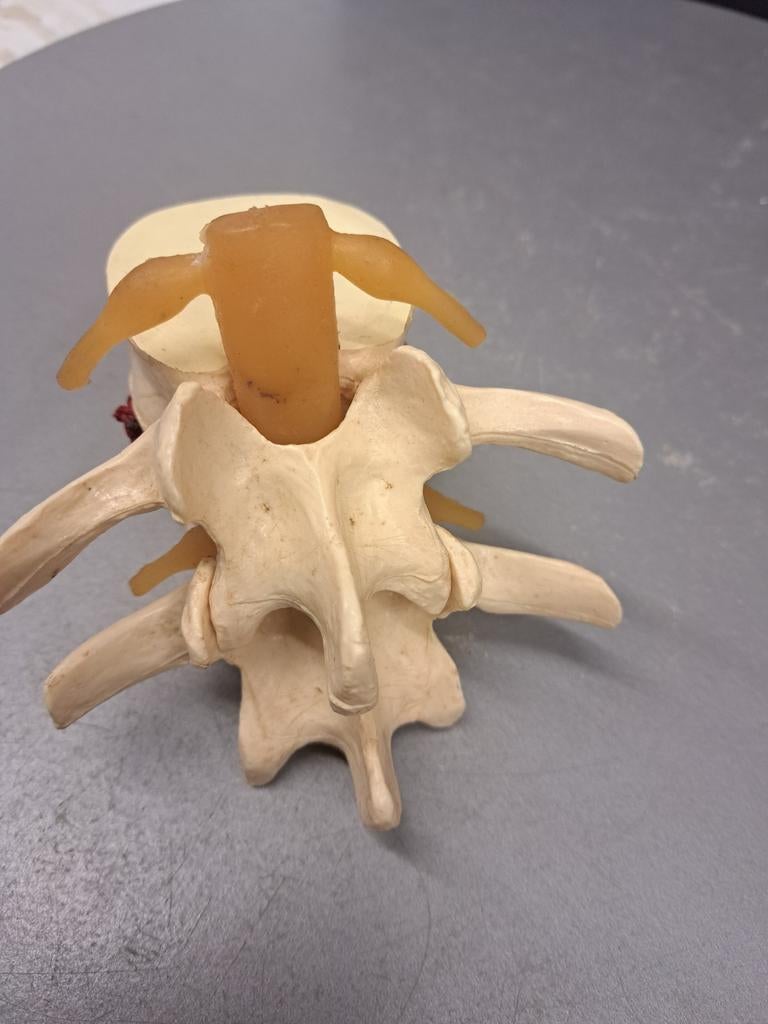 Lendenwervels Model Anatomisch Wervelkolom Lumbale Hernia An, Verzamelen, Ophalen of Verzenden, Zo goed als nieuw