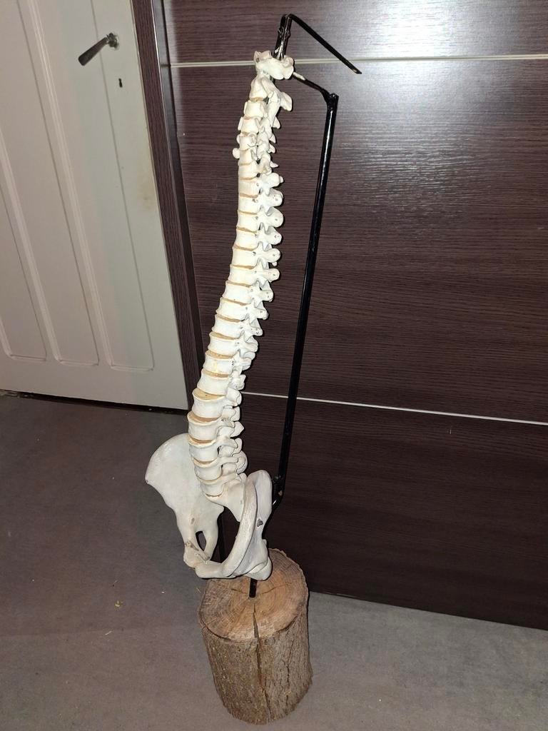 Wervelkolom (anatomisch model), Ophalen