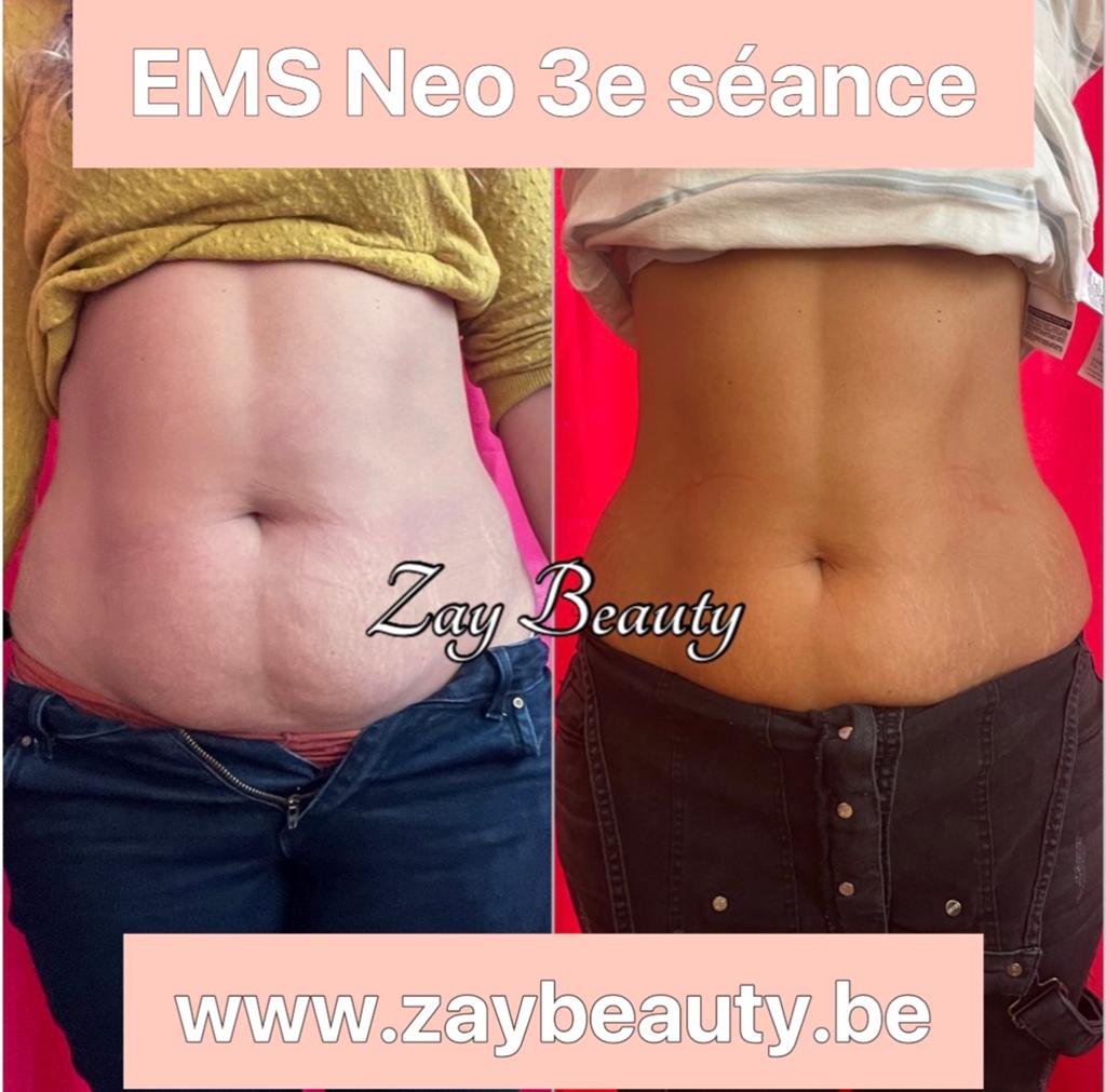 Ems Neo pour perdre 30% de graisse en 4 seances, Bijoux, Sacs & Beauté, Beauté | Cosmétiques & Maquillage, Enlèvement