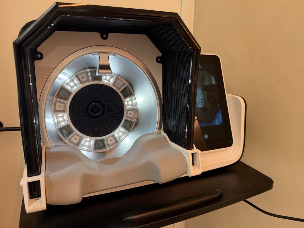 Skin Analysis System, Ophalen