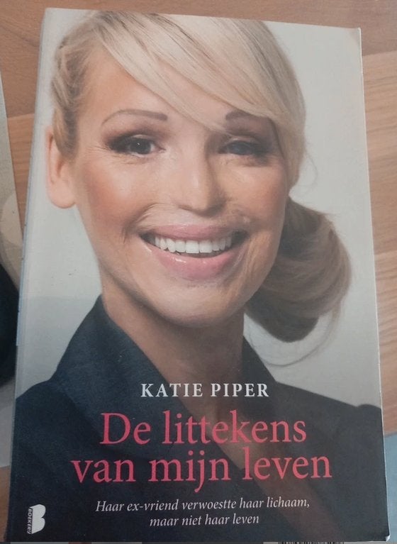 waargebeurd - de littekens van mijn leven, Boeken, Ophalen of Verzenden, Gelezen