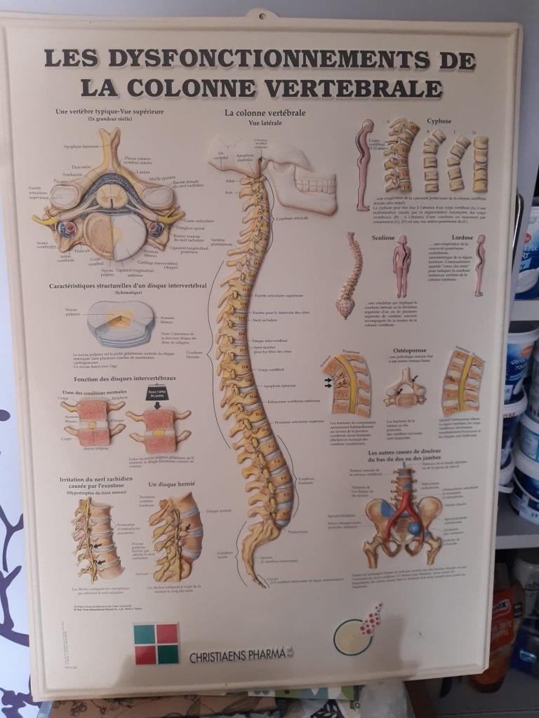 Planche anatomique colonne vertébrale - Christiaens Pharma, Enlèvement