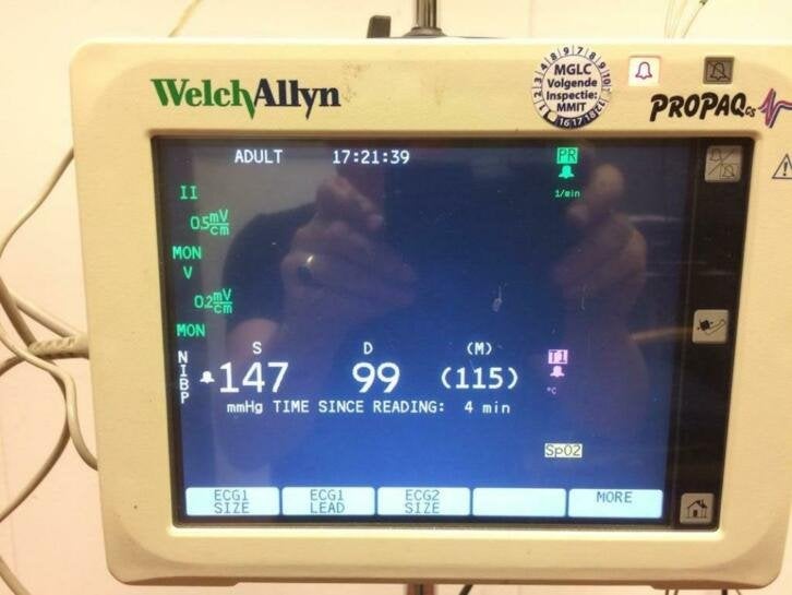 Welch Allyn vital signs monitor met toebehoren in koffer, Niet ingevuld, Gebruikt, Niet ingevuld, Ophalen of Verzenden