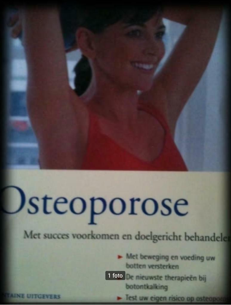 Osteoporose, Prof.dr.Reiner Bard, Livres, Santé, Diététique & Alimentation, Enlèvement, Maladie et Allergie