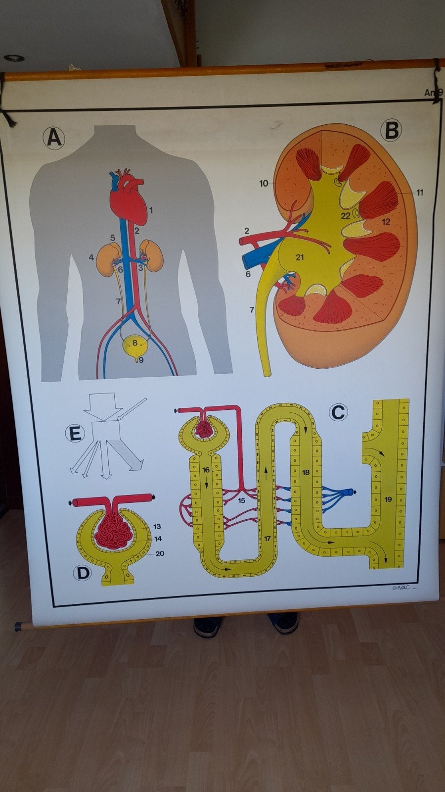 Affiche scolaire didactique : Les reins, Antiquités & Art, Enlèvement