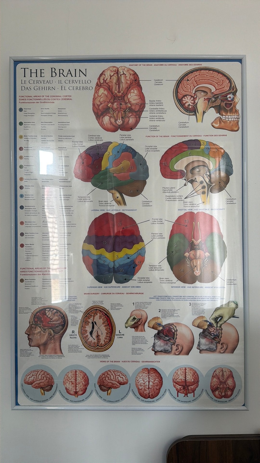 Poster inclusief kader - anatomie brein xl poster, Ophalen, Zo goed als nieuw