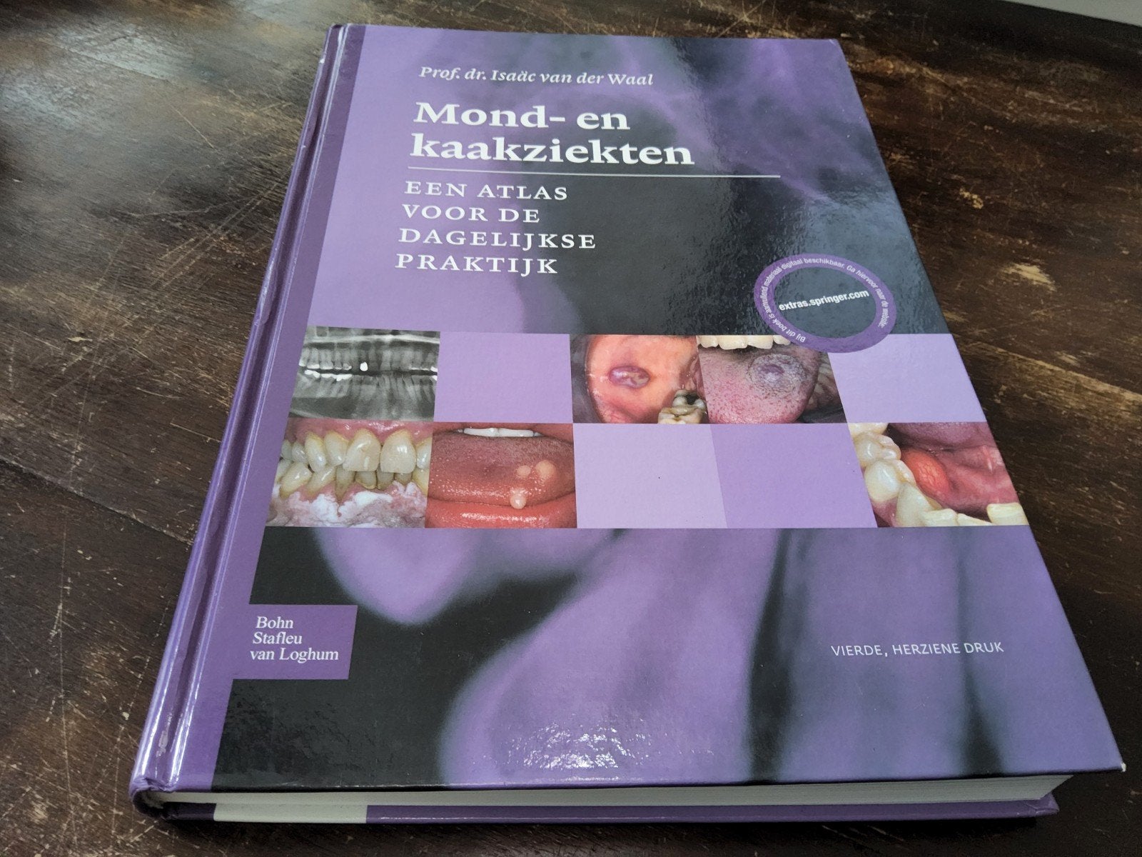 Mond- en kaakziekten, Ophalen