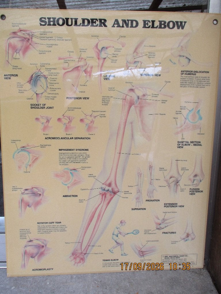 Medische pancarde schouder en elleboog, Ophalen of Verzenden