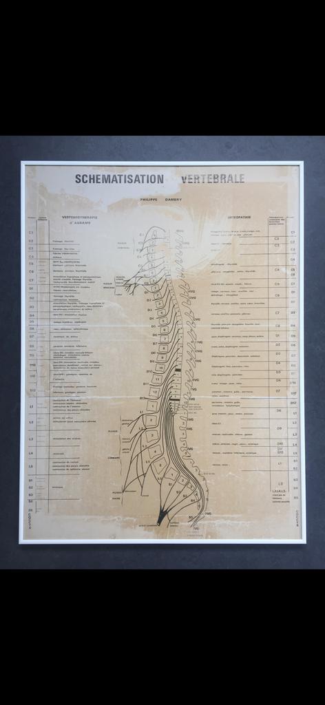 Tableau avec cadre en verre schématisation vertébrale, Enlèvement