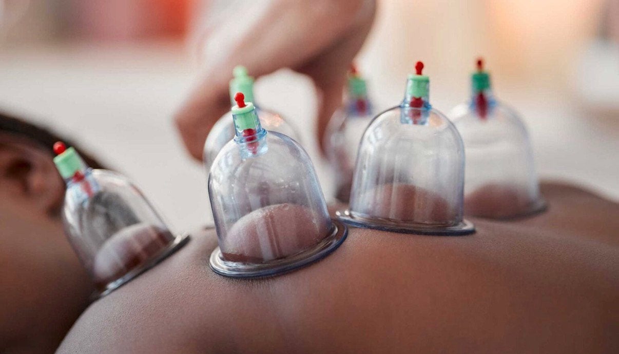 Cupping, Enlèvement ou Envoi