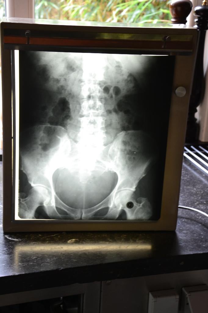 vintage lichtbak voor röntgenfoto's, Antiek en Kunst, Ophalen