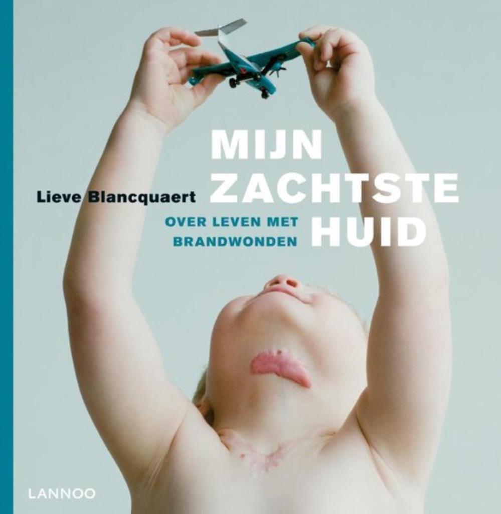 Mijn Zachtste Huid - Over leven met brandwonden, Boeken, Kunst en Cultuur | Fotografie en Design, Lieve Blancquaert, Nieuw, Ophalen of Verzenden