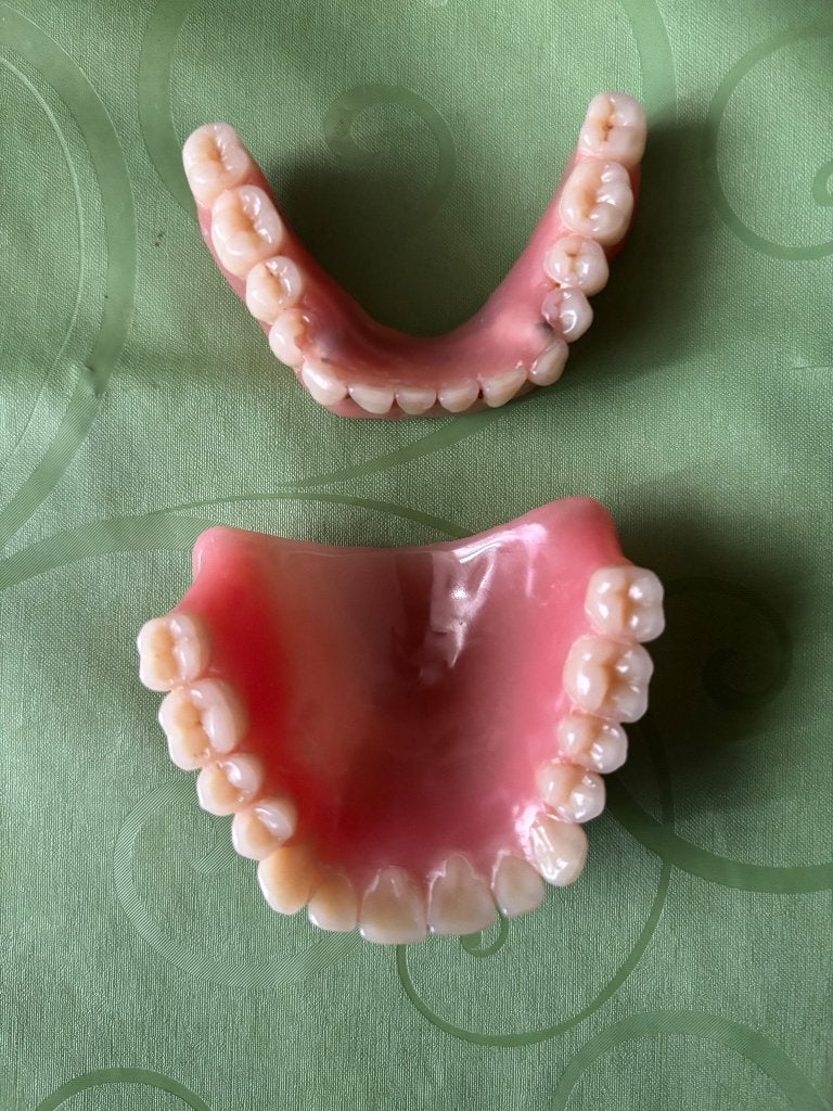 De nouvelles dents, Enlèvement, Neuf