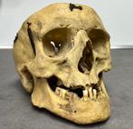 Schedel / Mens / Anatomie / Lesmateriaal  / Antiek / Skull, Collections, Collections Autre, Utilisé, Enlèvement ou Envoi