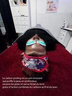 !! Promo!! Carbone Peeling gezichtsverzorging, Ophalen, Nieuw, Gehele gezicht, Verzorging