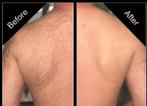 Epilation, Offres d'emploi