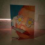 Ana barriga, Ophalen