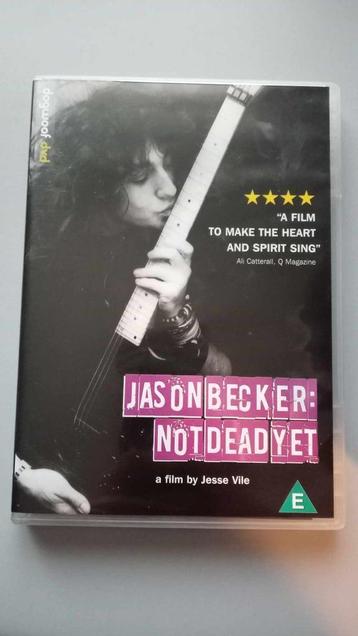 Jason Becker - Not Dead Yet DVD
