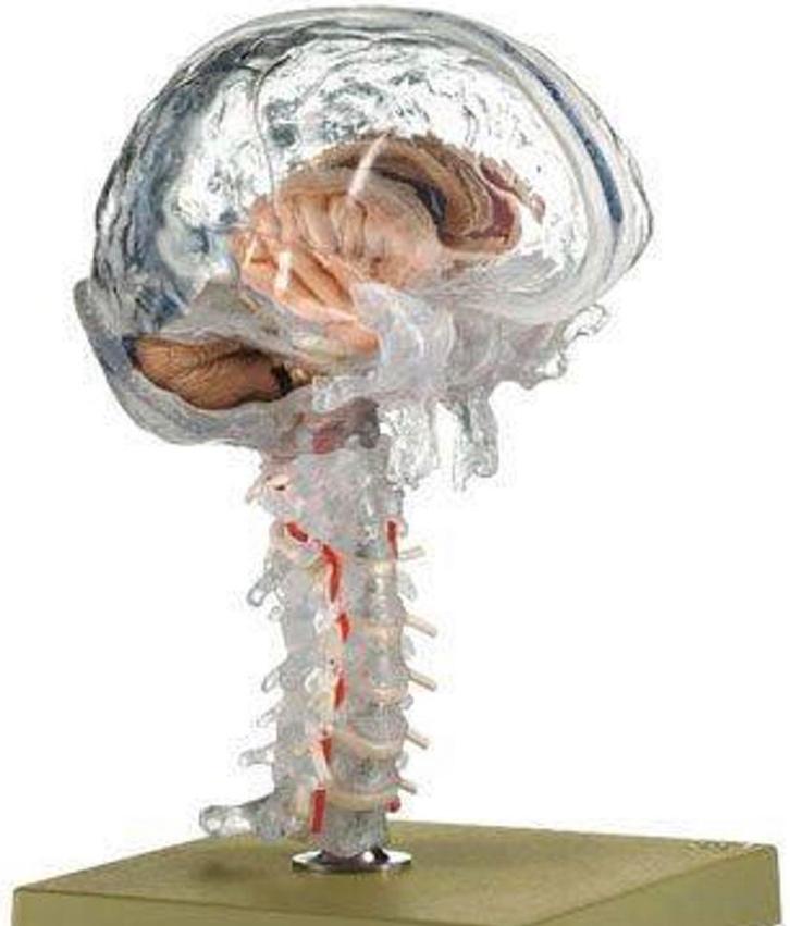 Modèle pièces détachées du cerveau en 15 parties, Divers, Matériel Infirmier, Comme neuf