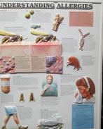 Medische plaat "Allergies" (kunststof), Antiek en Kunst, Antiek | Schoolplaten, Ophalen