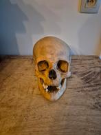 Schedel mens, Ophalen of Verzenden