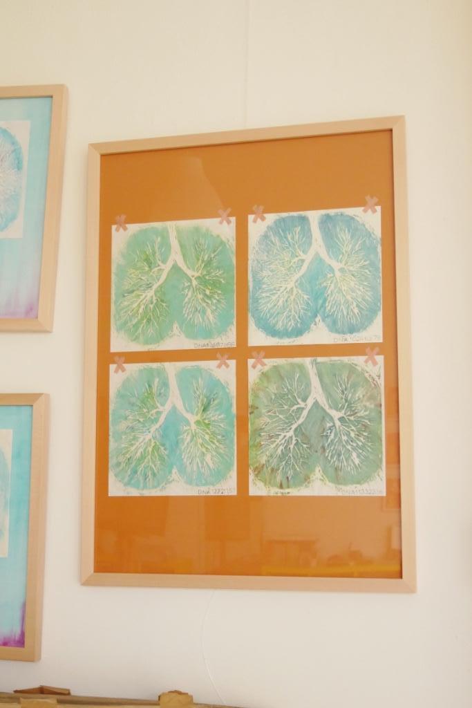 Longen DNA  - houtsnedes, Antiek en Kunst, Kunst | Etsen en Gravures, Ophalen