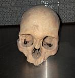 crâne humain, Enlèvement ou Envoi