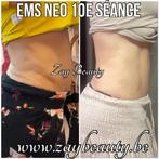 Ems Neo ems emsculpt, Handtassen en Accessoires, Uiterlijk | Dieet en Afvallen, Ophalen