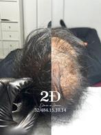 MicroPigmentation capillaire à bruxelles, Enlèvement, Neuf, Perruque ou Extension de cheveux