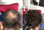 Zorg voor je haar, Handtassen en Accessoires, Uiterlijk | Haarverzorging, Ophalen, Nieuw, Tondeuse