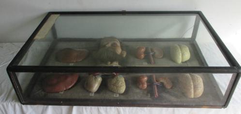 19th vitrine anatomisch wassen hoofd en organen dronkaard, Antiek en Kunst, Curiosa en Brocante, Ophalen