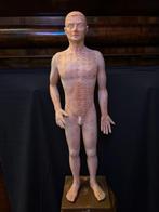 Acupunctuur mannetje, Enlèvement ou Envoi