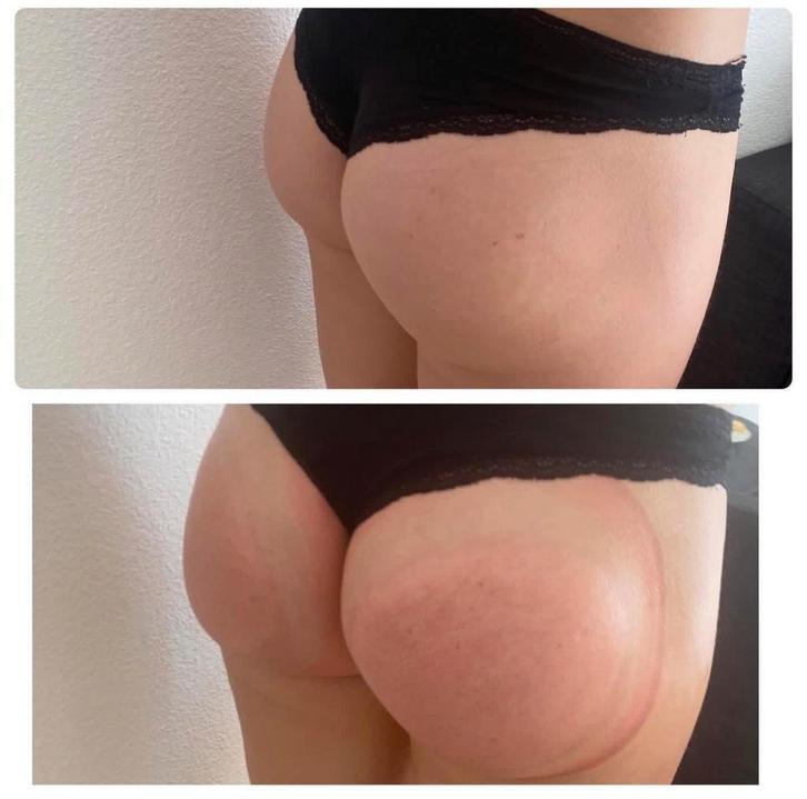 Lifting colombien, Bijoux, Sacs & Beauté, Beauté | Soins du corps, Enlèvement