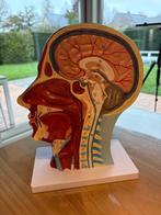 Anatomische doorsnede hoofd/nek van een mens, Ophalen