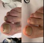 Medische pedicure te Berlare, Handtassen en Accessoires, Ophalen, Nieuw