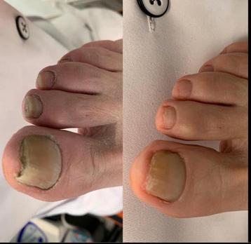 Medische pedicure te Berlare beschikbaar voor biedingen