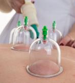Hijama, Sport en Fitness, Schietsport-accessoires, Ophalen of Verzenden