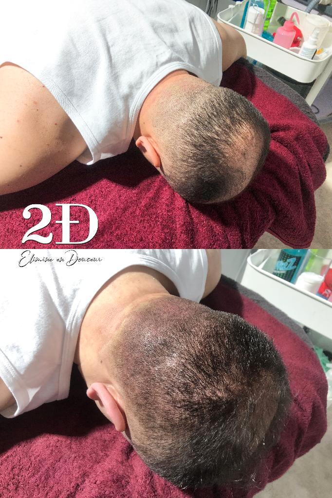 Verzorg je haar in Brussel, Handtassen en Accessoires, Uiterlijk | Haarverzorging, Nieuw, Haarverzorger of -hersteller, Ophalen