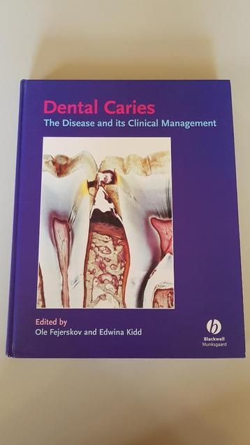 Dental Caries The Disease and its Clinical Management beschikbaar voor biedingen
