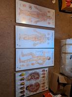 Kaders met acupunctuurposters, Huis en Inrichting, Woonaccessoires | Lijsten, Ophalen, Metaal of Aluminium, Zo goed als nieuw