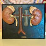 antiek plaaster niermodel anatomie, Enlèvement ou Envoi