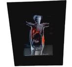 Luc Verstraete (1928-2008)., Enlèvement