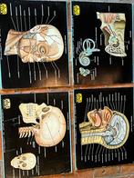 Crâne de plaque médicale, audition, muscles, Enlèvement ou Envoi