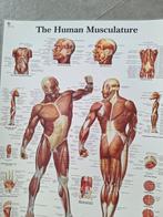 wandplaat (human musculature), Enlèvement, Comme neuf