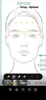 botox behandeling, Diensten en Vakmensen, Schoonheidsspecialisten | Overige