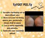 Foot peel, Ophalen of Verzenden