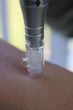 microneedling Tri-M mesotherapie dermapen schoonheidssalon, Ophalen of Verzenden, Zo goed als nieuw, Overige typen