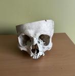 Crâne humain, Enlèvement ou Envoi